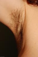 ATK hairy  in mature and hairy