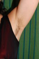 ATK hairy  in mature and hairy