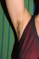 ATK hairy  in mature and hairy