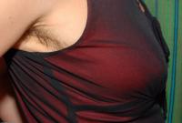 ATK hairy  in mature and hairy