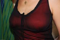 ATK hairy  in mature and hairy