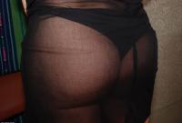 ATK hairy  in mature and hairy