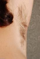 ATK hairy  in mature and hairy