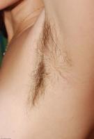 ATK hairy  in mature and hairy