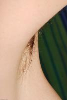 ATK hairy  in mature and hairy