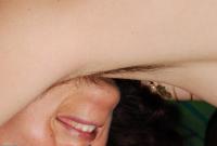 ATK hairy  in mature and hairy