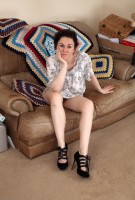 ATK hairy  in mature and hairy