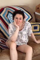 ATK hairy  in mature and hairy