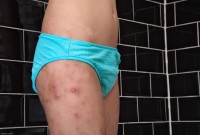 ATK hairy Cassidy Set