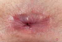 ATK hairy Cassidy Bliss Set