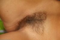 ATK hairy  in young and hairy
