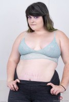 ATK hairy  in young and hairy