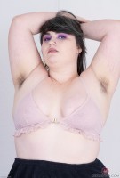 ATK hairy  in young and hairy