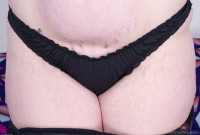 ATK hairy  in young and hairy