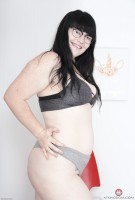 ATK hairy  in young and hairy