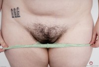 ATK hairy  in young and hairy