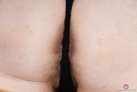 ATK hairy  in young and hairy