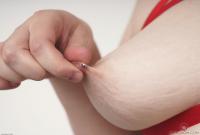 ATK hairy  in young and hairy