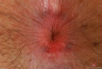 ATK hairy Cece Lachey Set