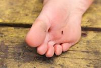 ATK hairy Chastity in scary hairy