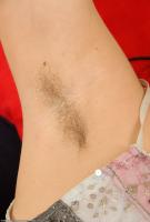 ATK hairy Chloe Set