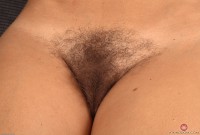 ATK hairy  in mature and hairy