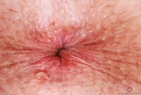 ATK hairy Chloe Foster Set