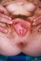 ATK hairy  in mature and hairy