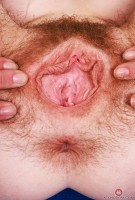 ATK hairy  in mature and hairy
