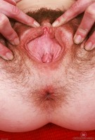 ATK hairy  in mature and hairy