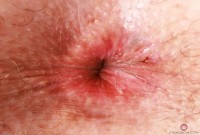 ATK hairy Chloe Foster Set