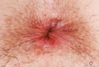 ATK hairy Chloe Foster Set