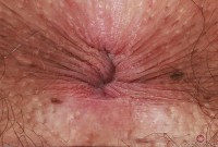 ATK hairy Chloe Kreams Set