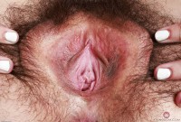 ATK hairy  in young and hairy