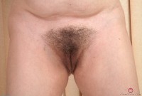 ATK hairy  in mature and hairy