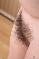 ATK hairy  in mature and hairy