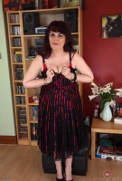 ATK hairy  in mature and hairy