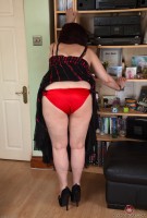 ATK hairy  in mature and hairy