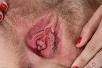 ATK hairy  in young and hairy