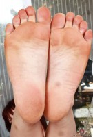 ATK hairy  in young and hairy