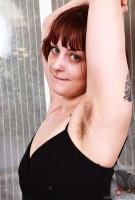 ATK hairy  in young and hairy