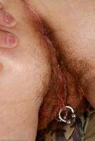 ATK hairy  in mature and hairy