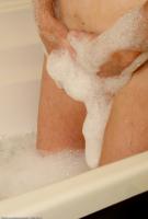 ATK hairy  in mature and hairy