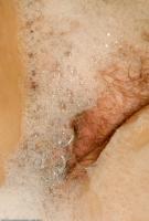 ATK hairy  in mature and hairy