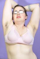 ATK hairy  in mature and hairy