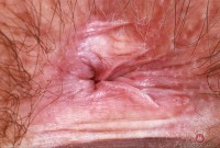ATK hairy Annabelle Lee in mature and hairy
