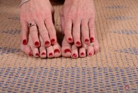 ATK hairy  in mature and hairy