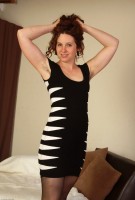 ATK hairy  in mature and hairy