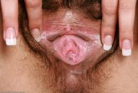ATK hairy Daisy Set