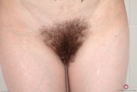 ATK hairy  in young and hairy
